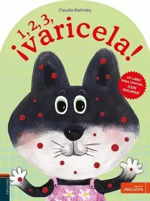1, 2, 3, ¡VARICELA!