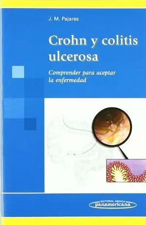 CROHN Y COLITIS ULCEROSA